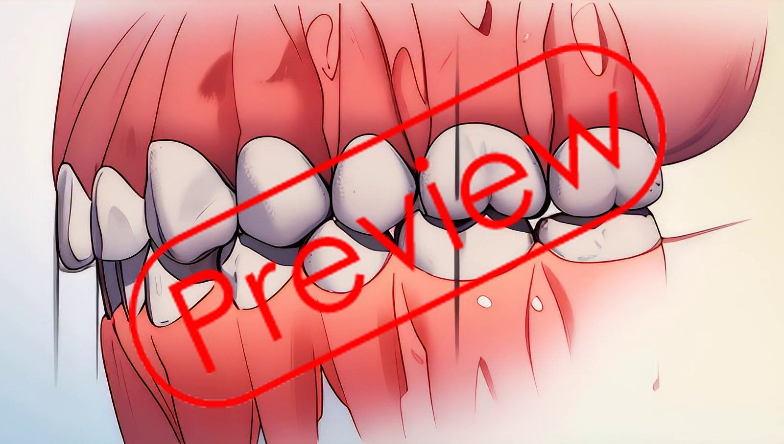 Dental Anime Orthodontics 09x01 - Payhip