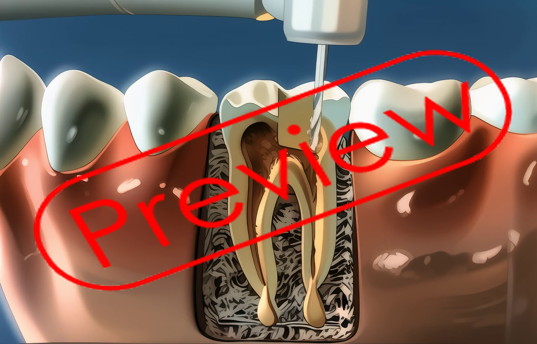 Dental Anime Endodontics o37 - Payhip