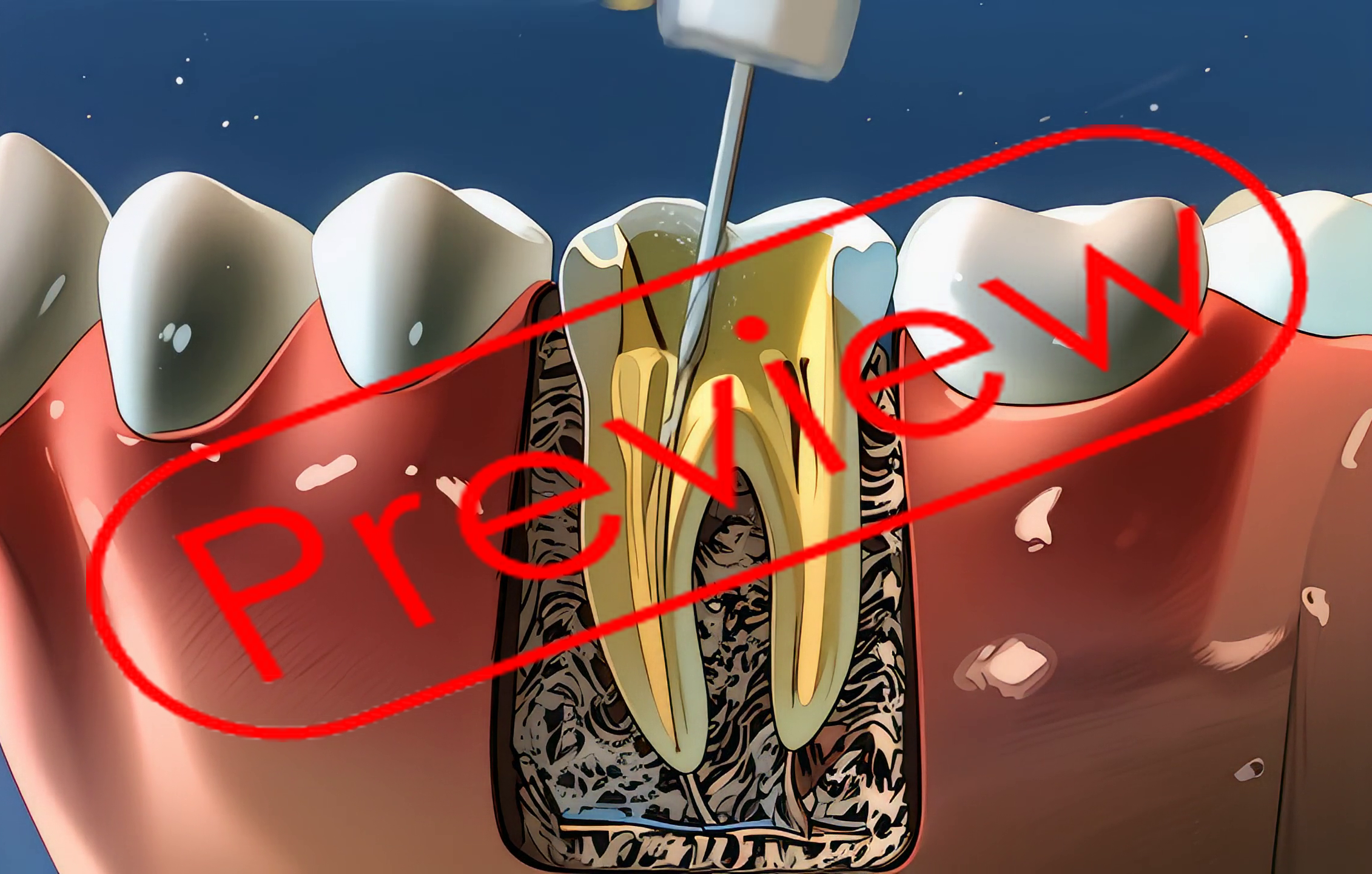 Dental Anime Endodontics v9 - Payhip