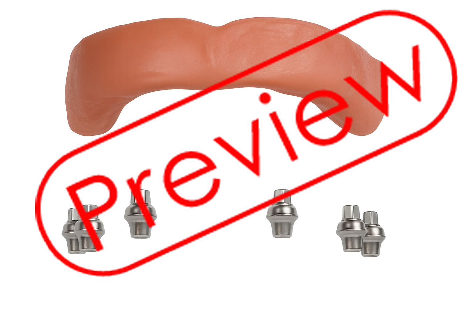 Implant Surgery 95w67365x - Payhip