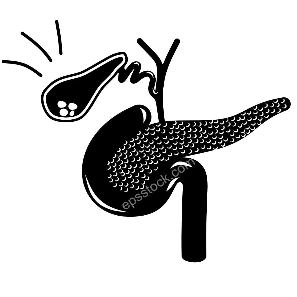 Acute cholecystitis symbol