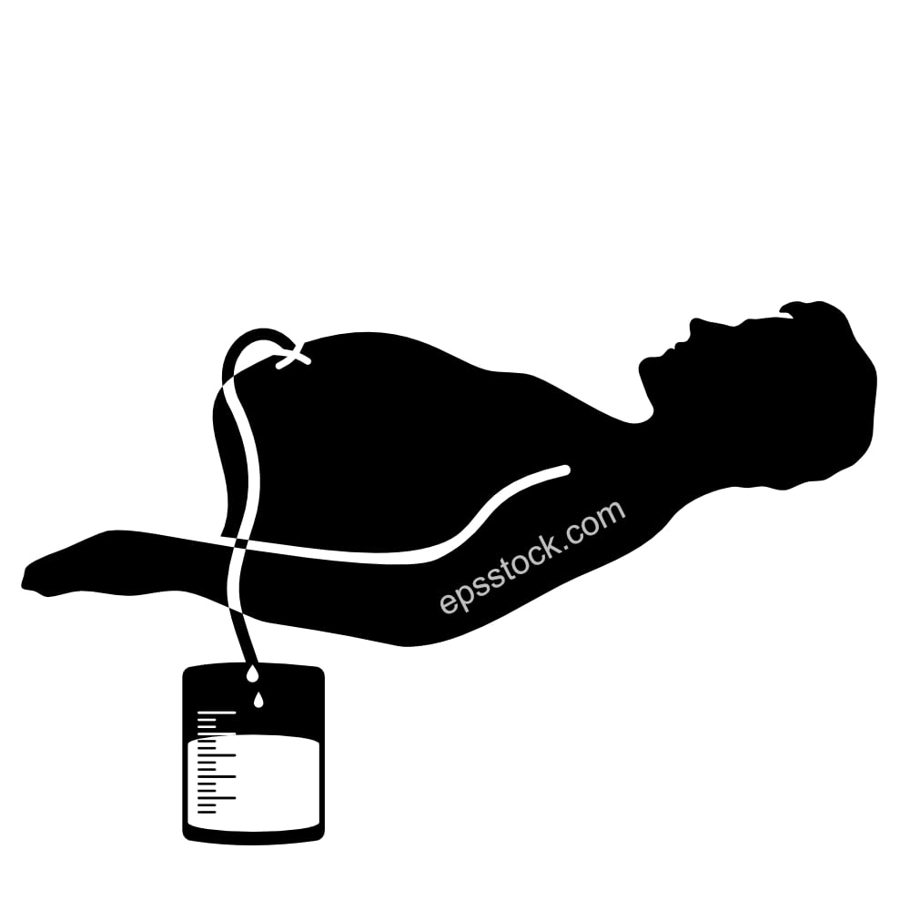 Abdominal paracentesis