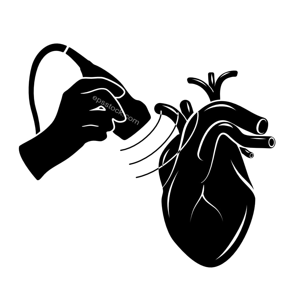 Ultrasound of the heart