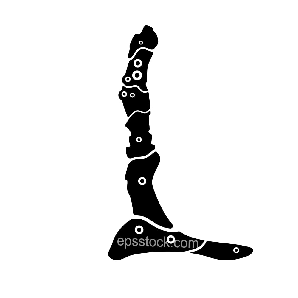prosthetic leg