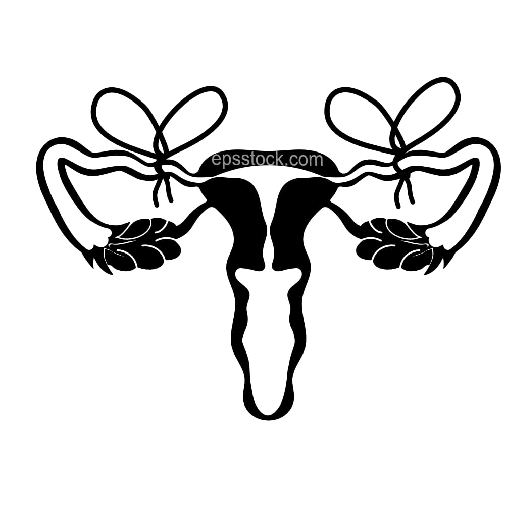 tubal ligation surgery