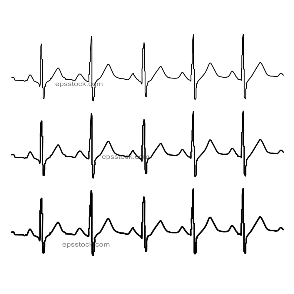 cardiogram line