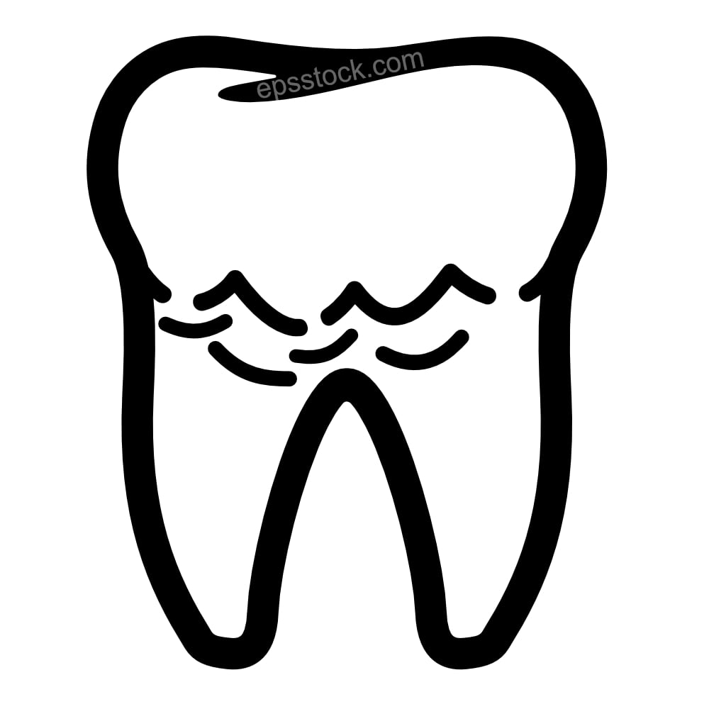 Tartar Or Calculus Teeth