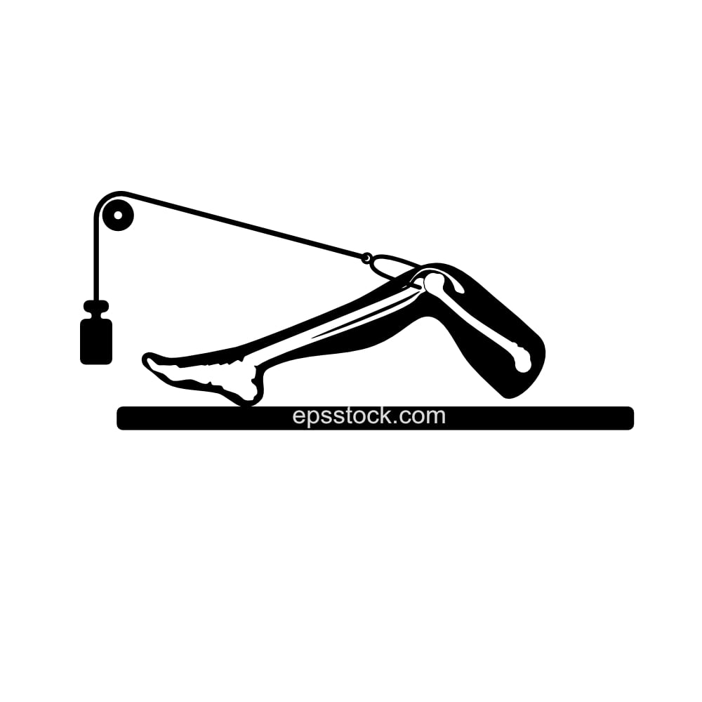 Tibial Skeletal Traction