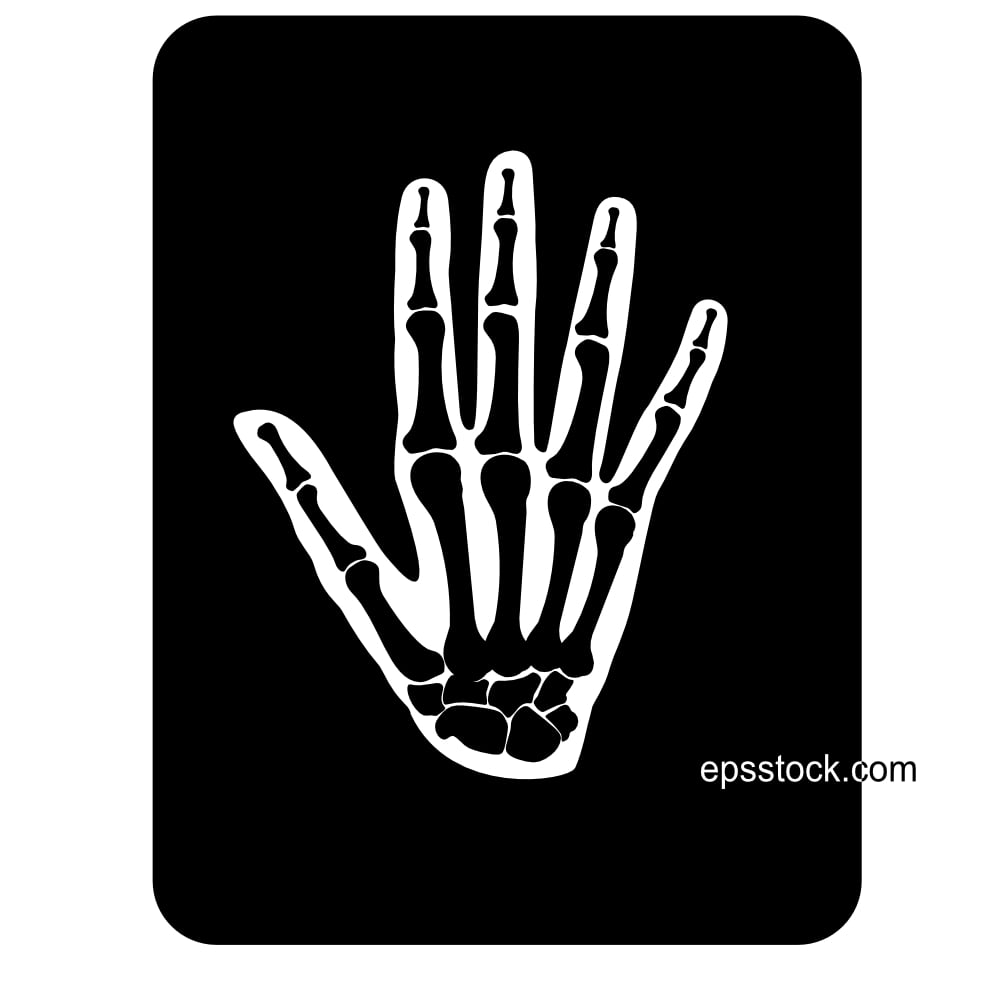 x-ray of hand