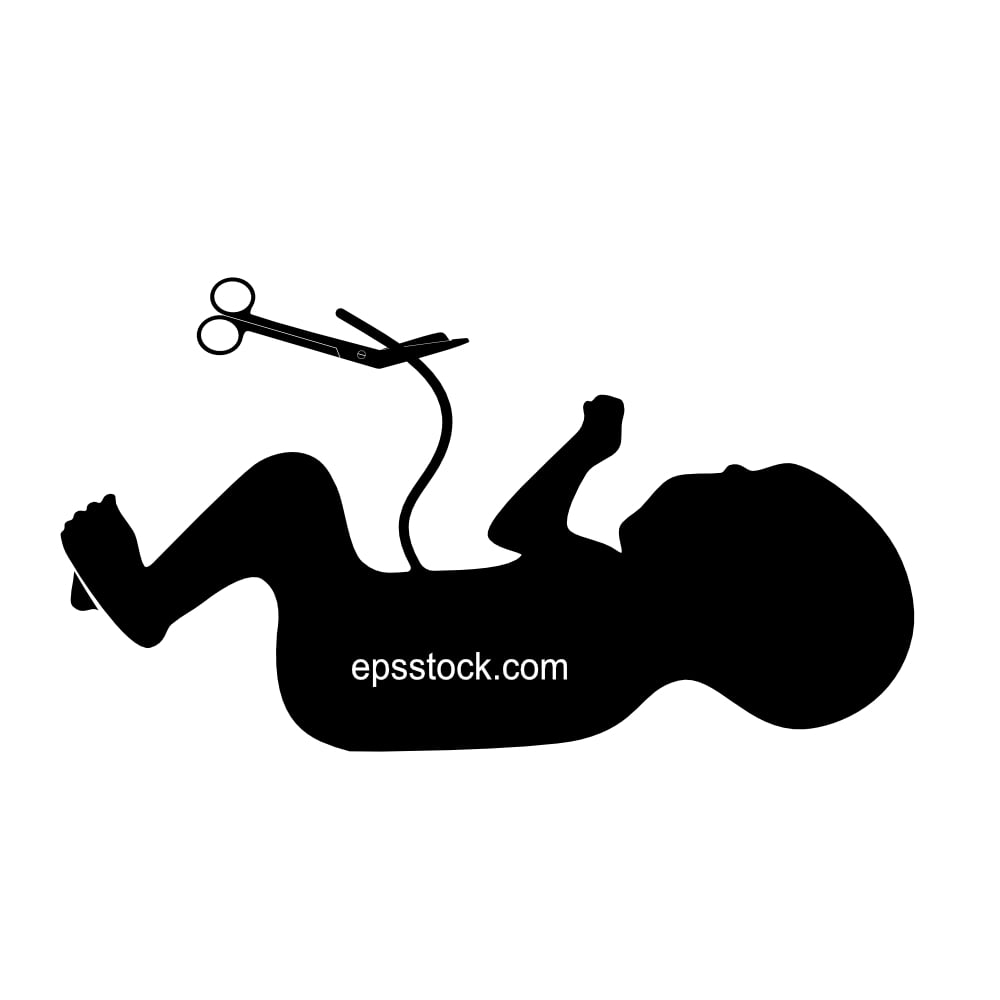 cutting the umbilical cord