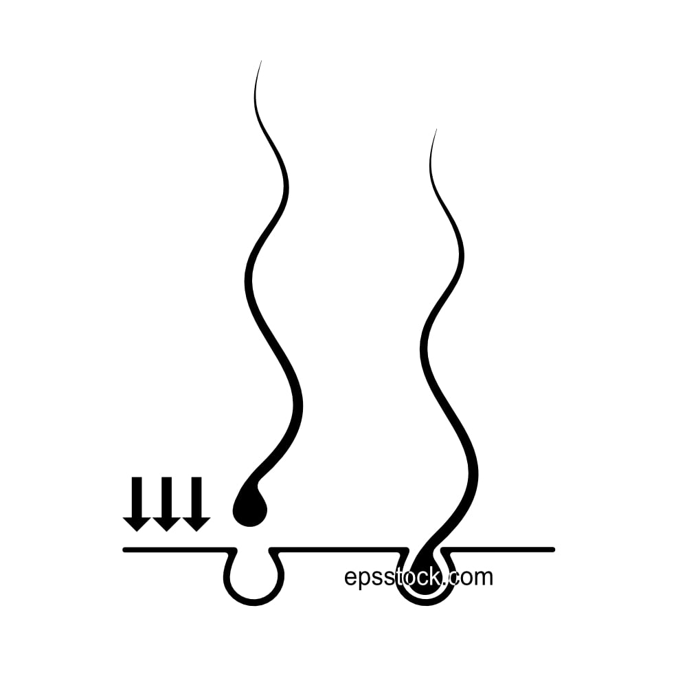 hair transplantation