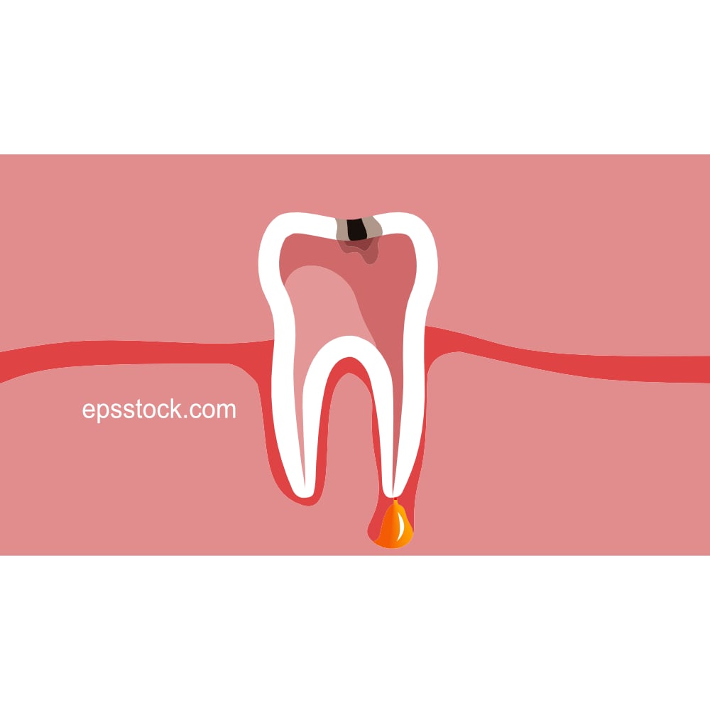 periodontitis emblem