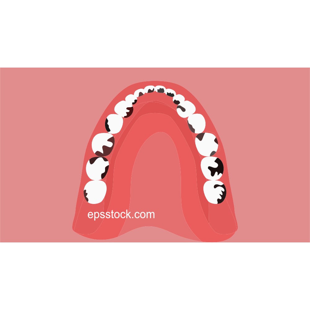 Periodontitis and systemic disease