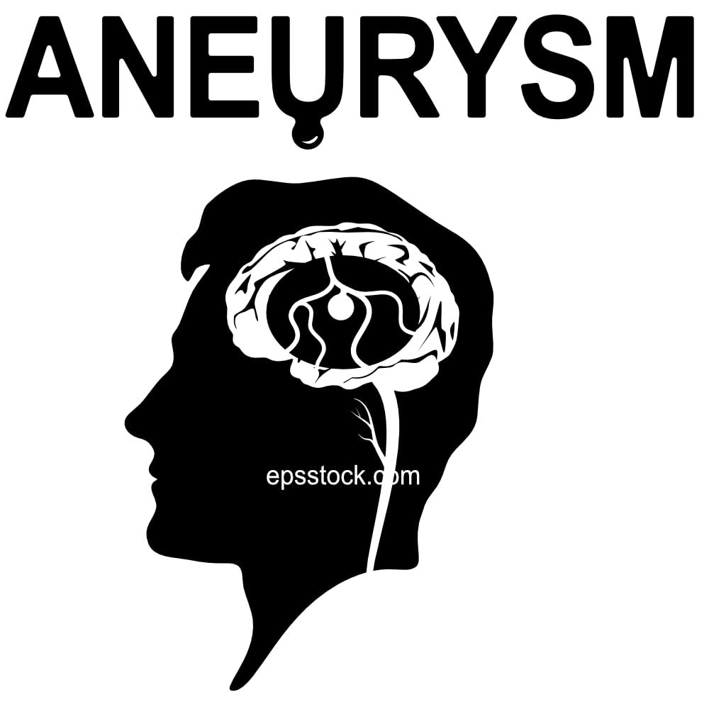 Brain aneurysm