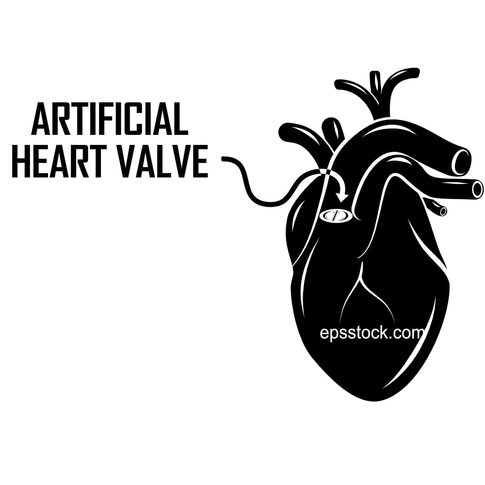 artificial heart valve in operation