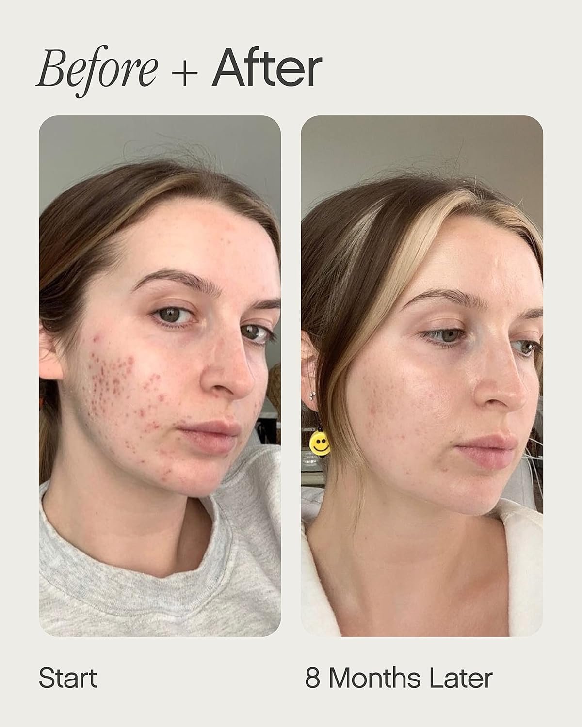 skin products for dark spots