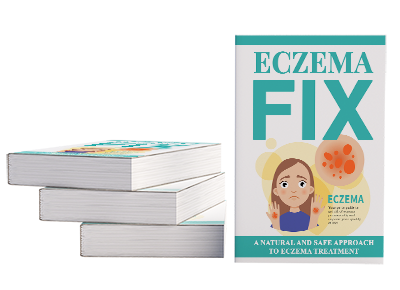 Eczema Fix instant download PDF eBook for natural skin relief