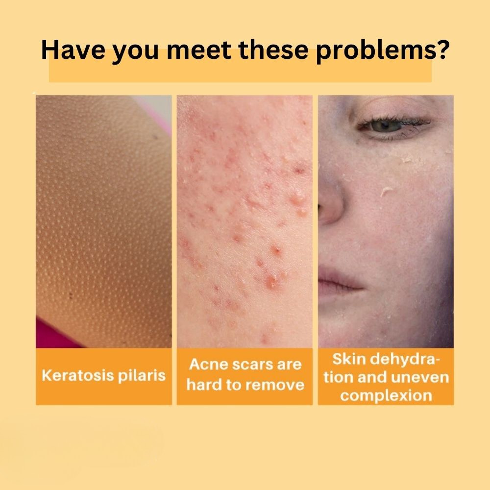 Kojic acid soap face and body cleansing beauty bar