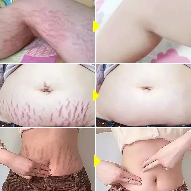 ✨ Gentle daily self-care ritual ✨ Helps skin feel moisturized and smooth ✨ Fast-absorbing, non-greasy feel ✨ A beautiful gift idea for expecting moms Celebrate every stage of pregnancy with a simple ritual of love, care, and confidence. 🤍 For external use only. Every pregnancy and skin type is different.